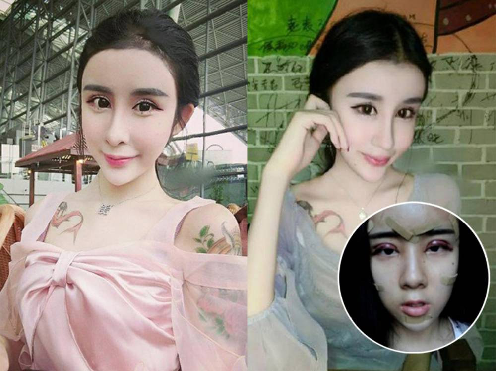 Esta niña china de 15 años se ha sometido a cirugía plástica extrema